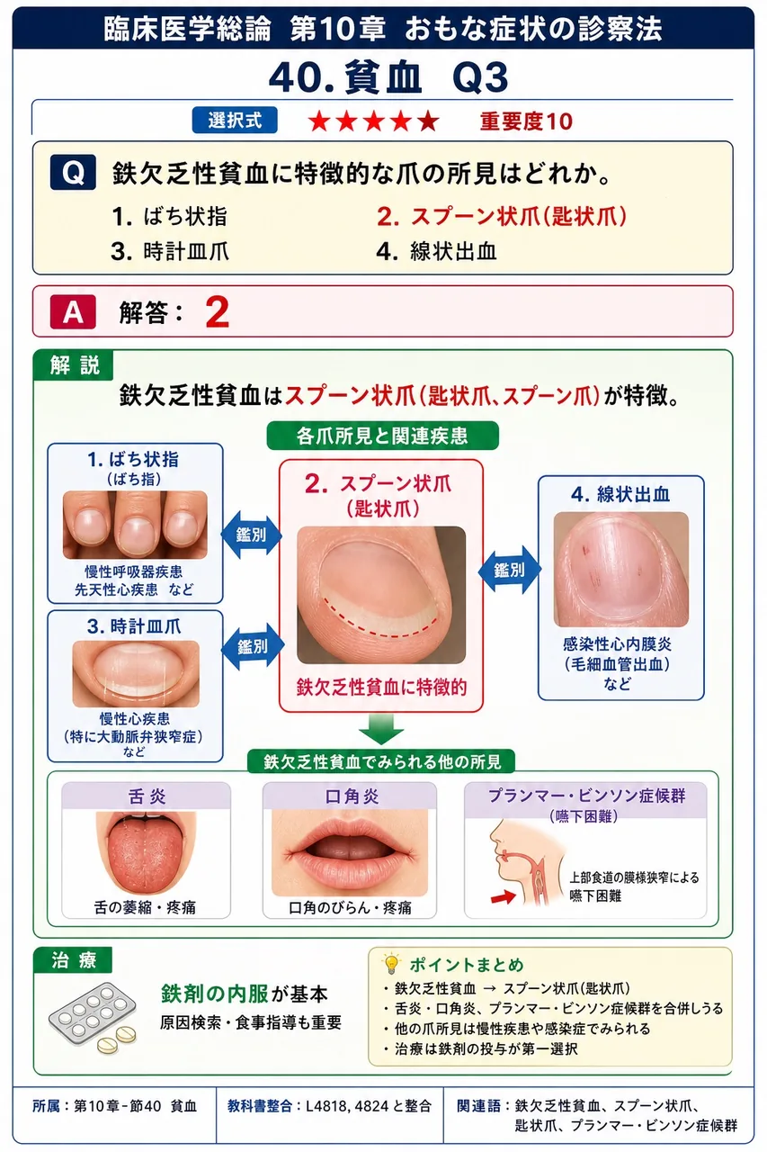 鉄欠乏性貧血に特徴的な爪の所見はどれか。 解説図