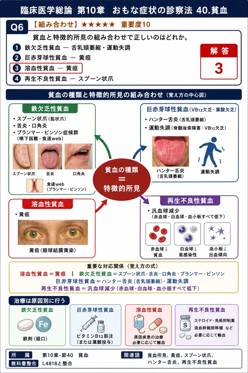 貧血と特徴的所見の組み合わせで正しいのはどれか。 解説図