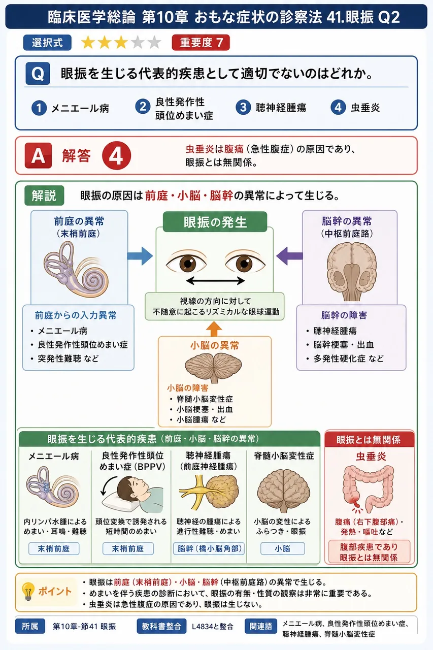 眼振を生じる代表的疾患として適切でないのはどれか。 解説図