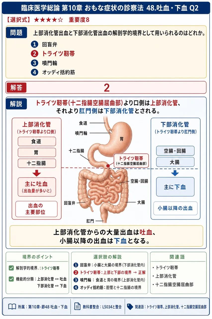 上部消化管出血と下部消化管出血の解剖学的境界として用いられるのはどれか。 解説図