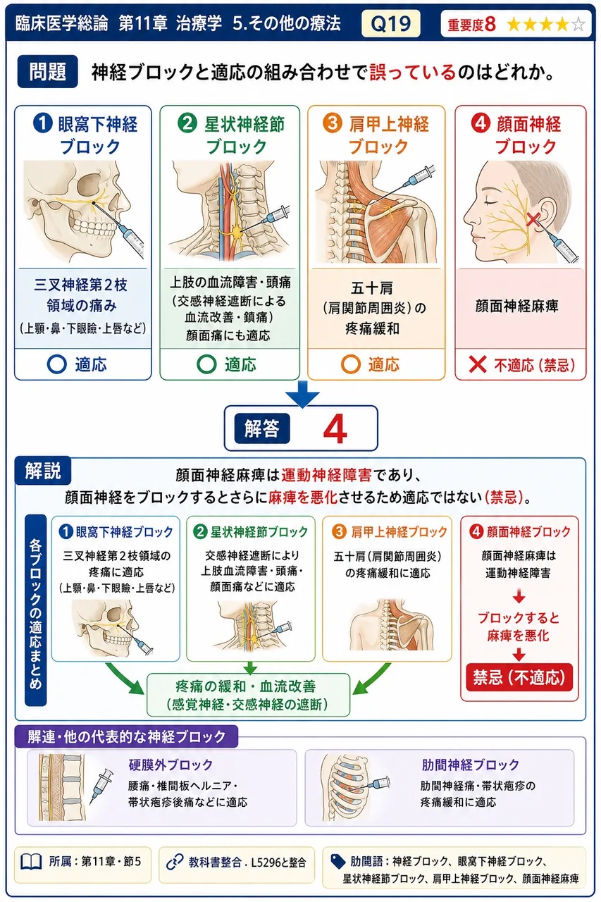 神経ブロックと適応の組み合わせで誤っているのはどれか。 解説図