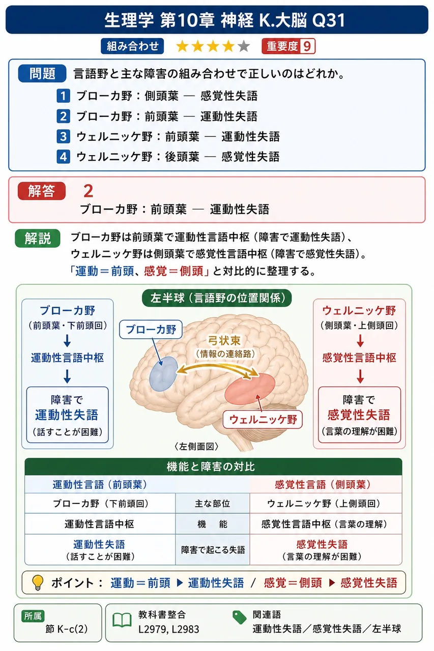 言語野と主な障害の組み合わせで正しいのはどれか。 解説図