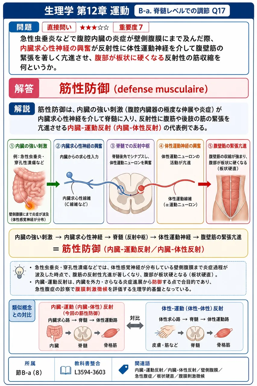 急性虫垂炎などで腹腔内臓の炎症が壁側腹膜にまで及んだ際、内臓求心性神経の興奮が反射性に体性運動神経を介して腹壁筋の緊張を著しく亢進させ、腹部が板状に硬くなる反射性の筋収縮を何というか。 解説図