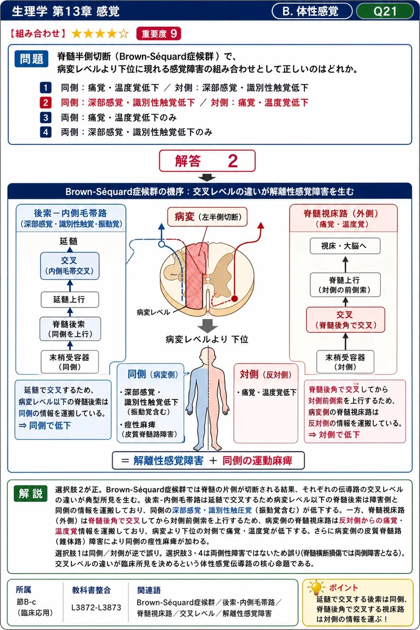 脊髄半側切断（Brown-Séquard症候群）で、病変レベルより下位に現れる感覚障害の組み合わせとして正しいのはどれか。 解説図