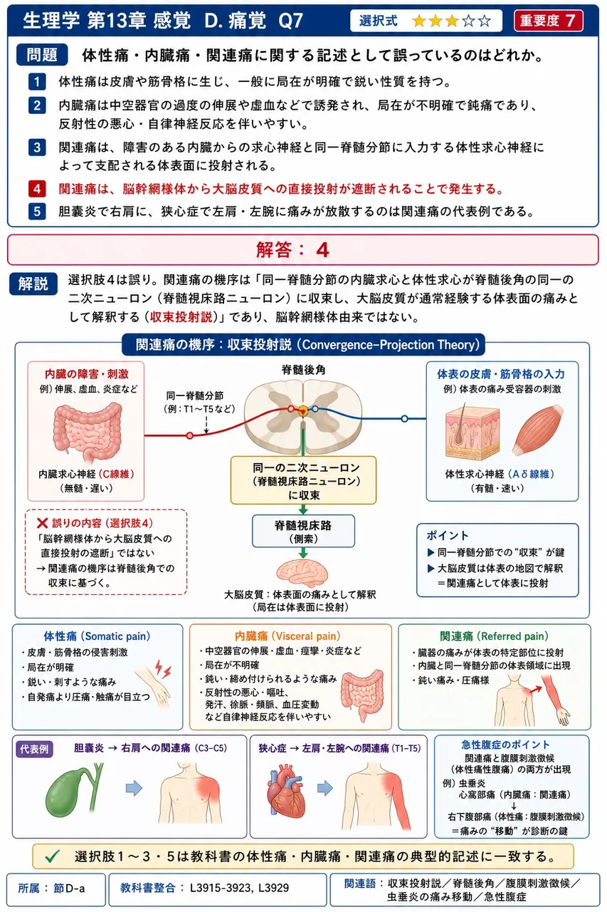 体性痛・内臓痛・関連痛に関する記述として誤っているのはどれか。 解説図