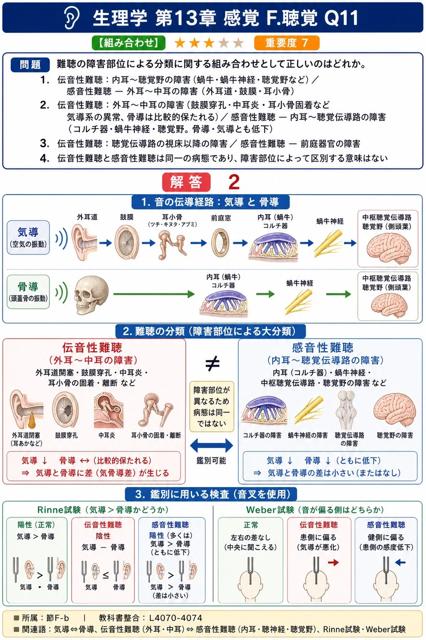 難聴の障害部位による分類に関する組み合わせとして正しいのはどれか。 解説図