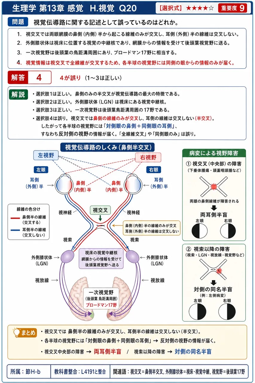 視覚伝導路に関する記述として**誤っている**のはどれか。 解説図