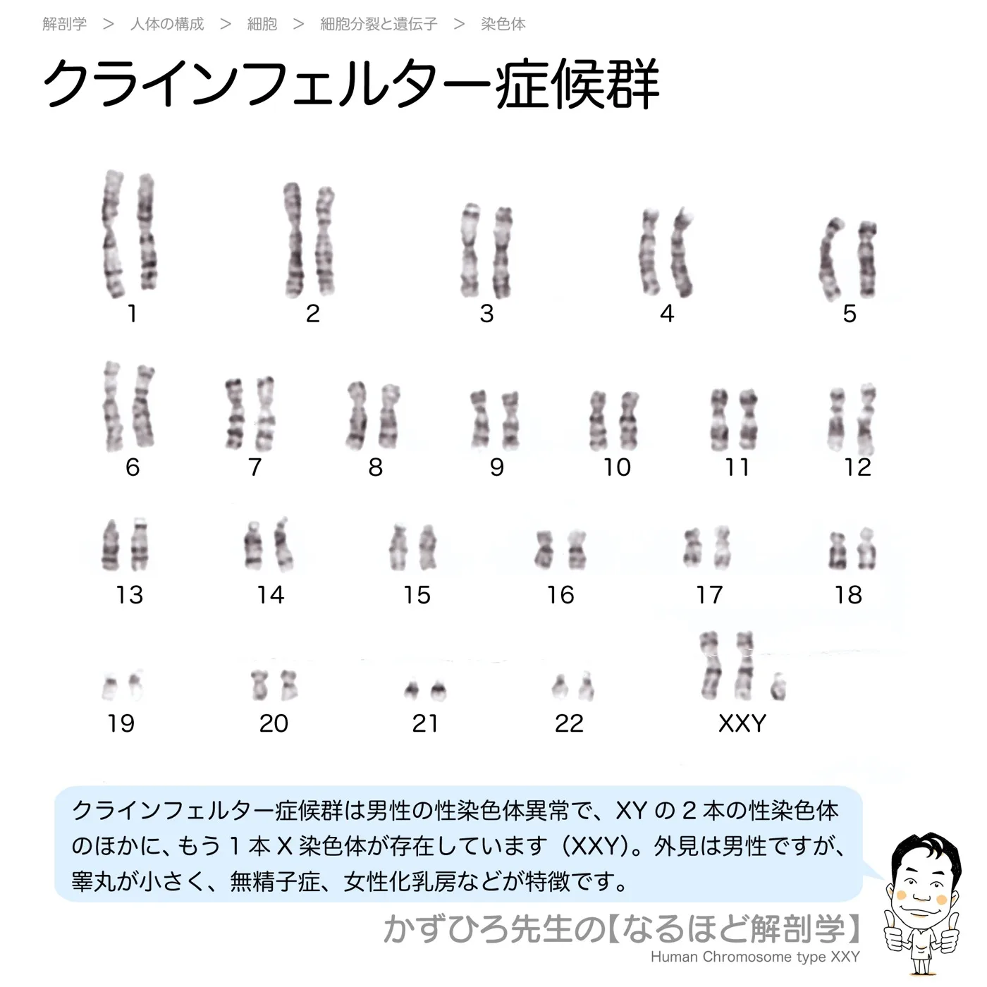 クラインフェルター症候群