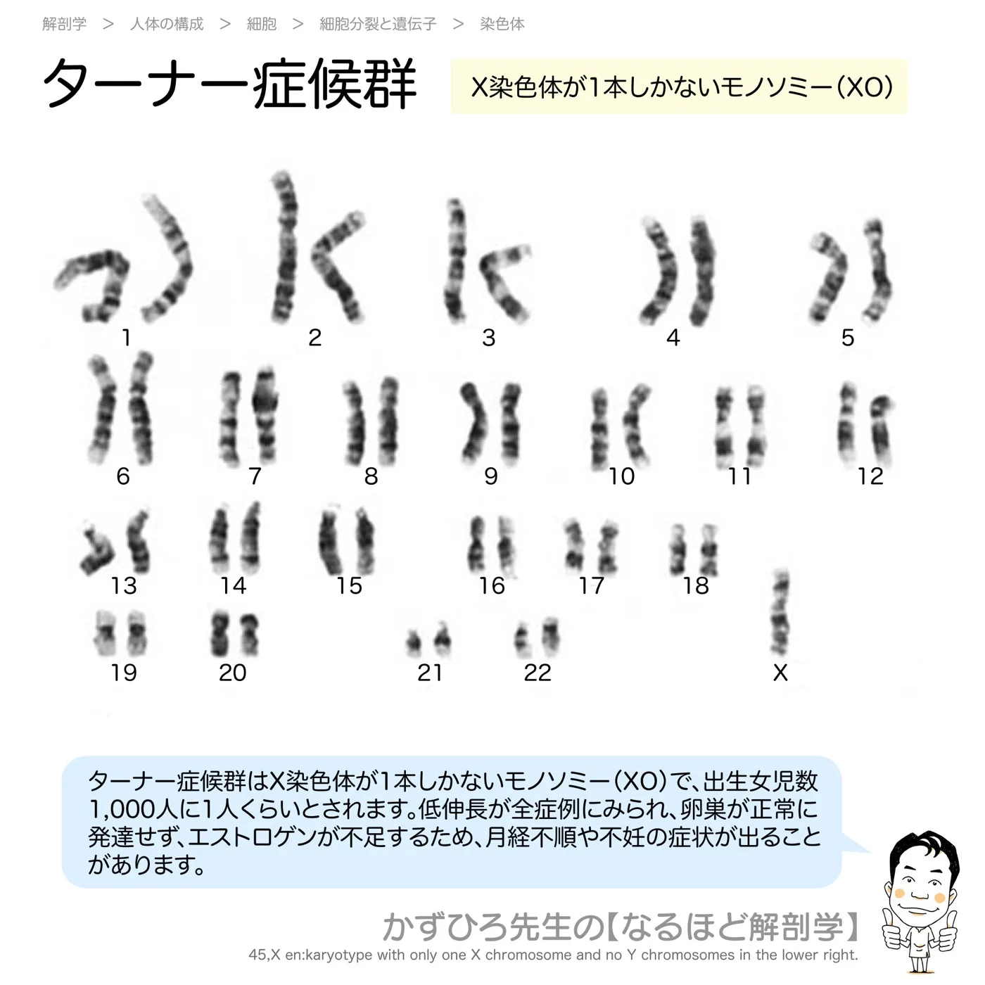 ターナー症候群