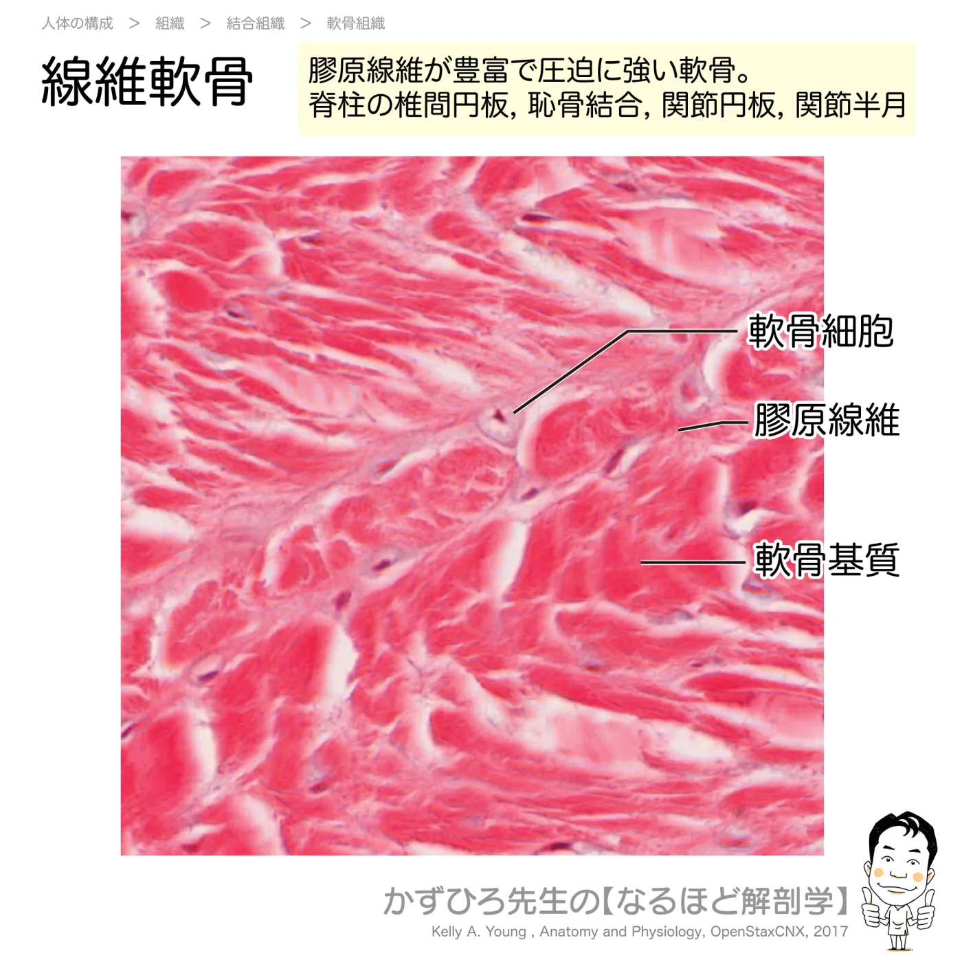 線維軟骨