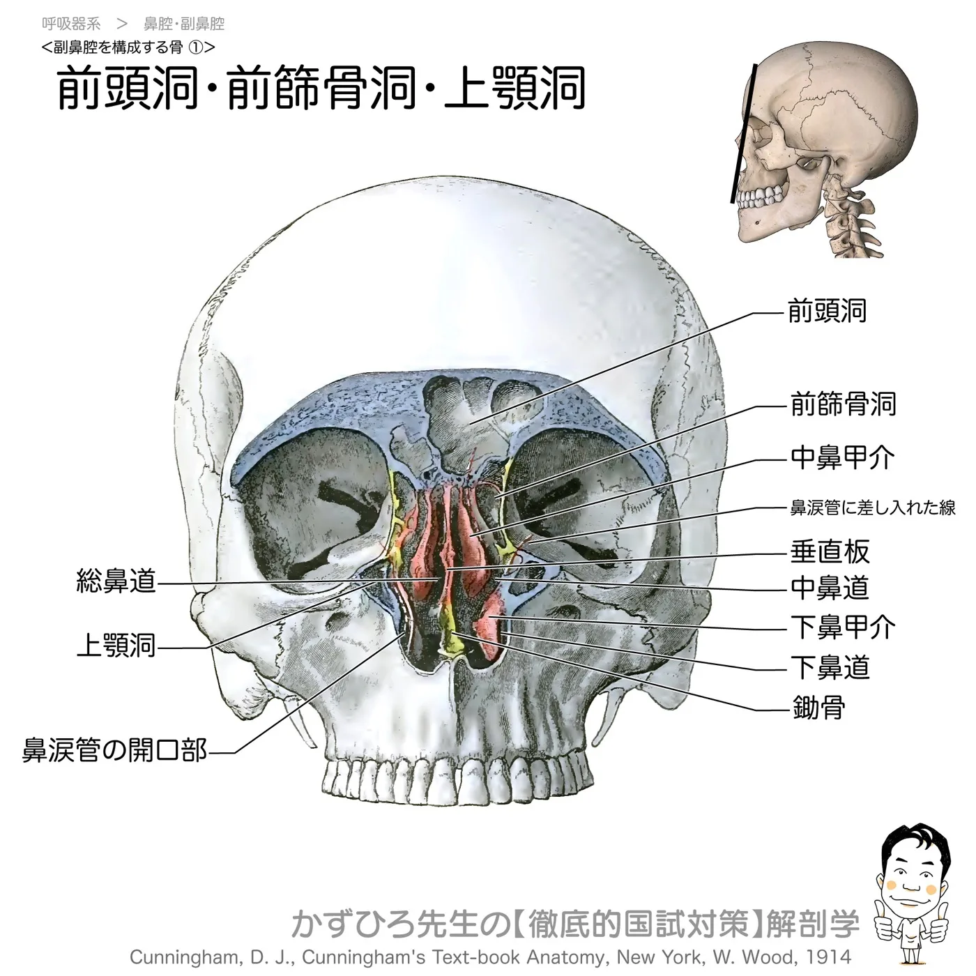 副鼻腔前額断-1-前頭洞・上顎洞