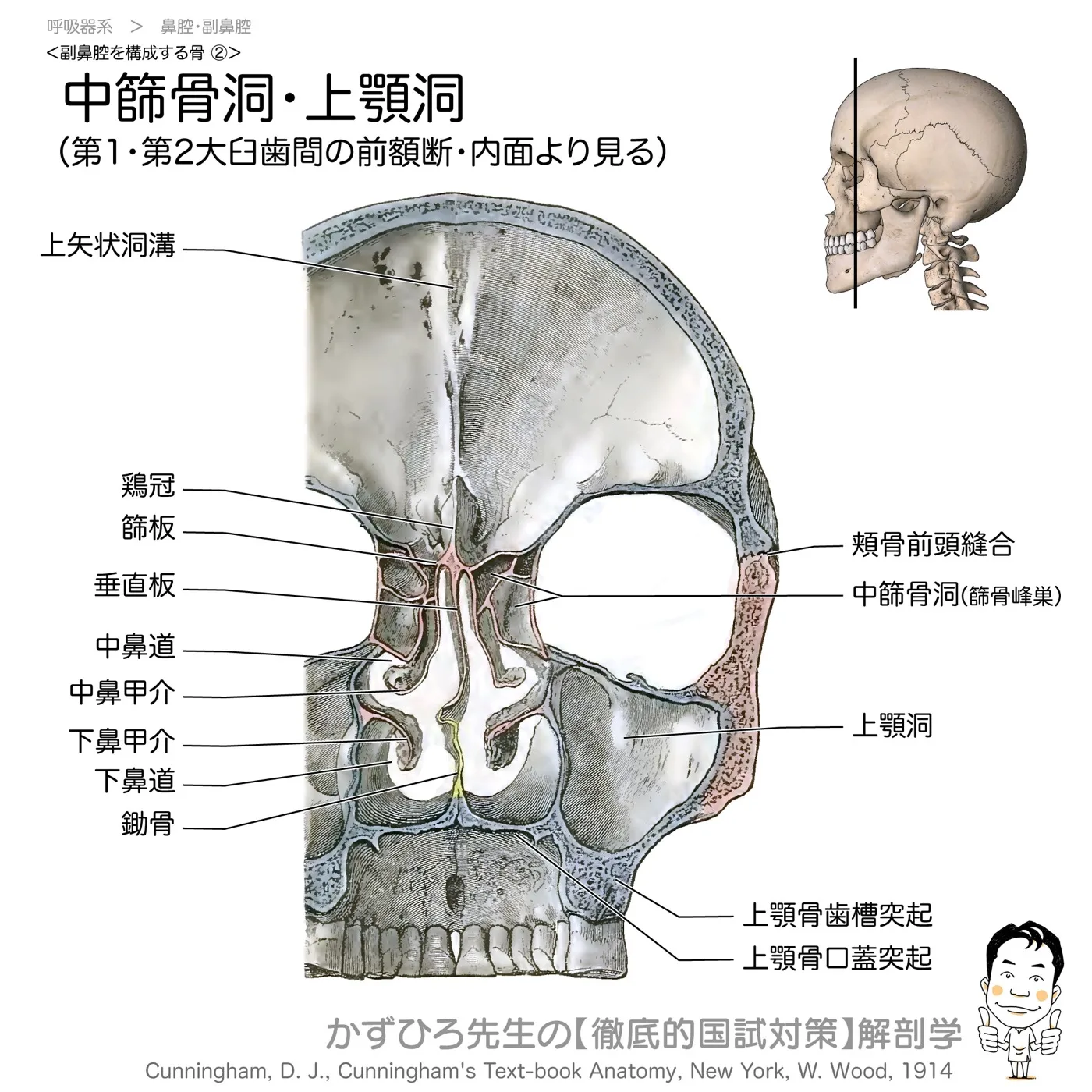 副鼻腔前額断