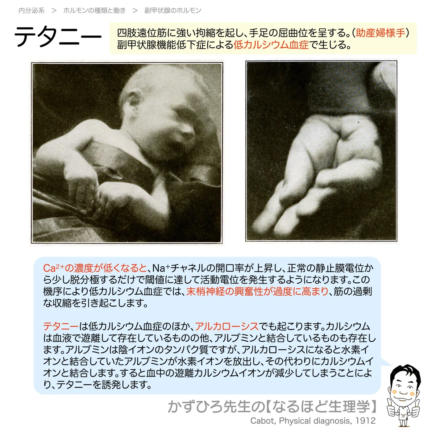 テタニー