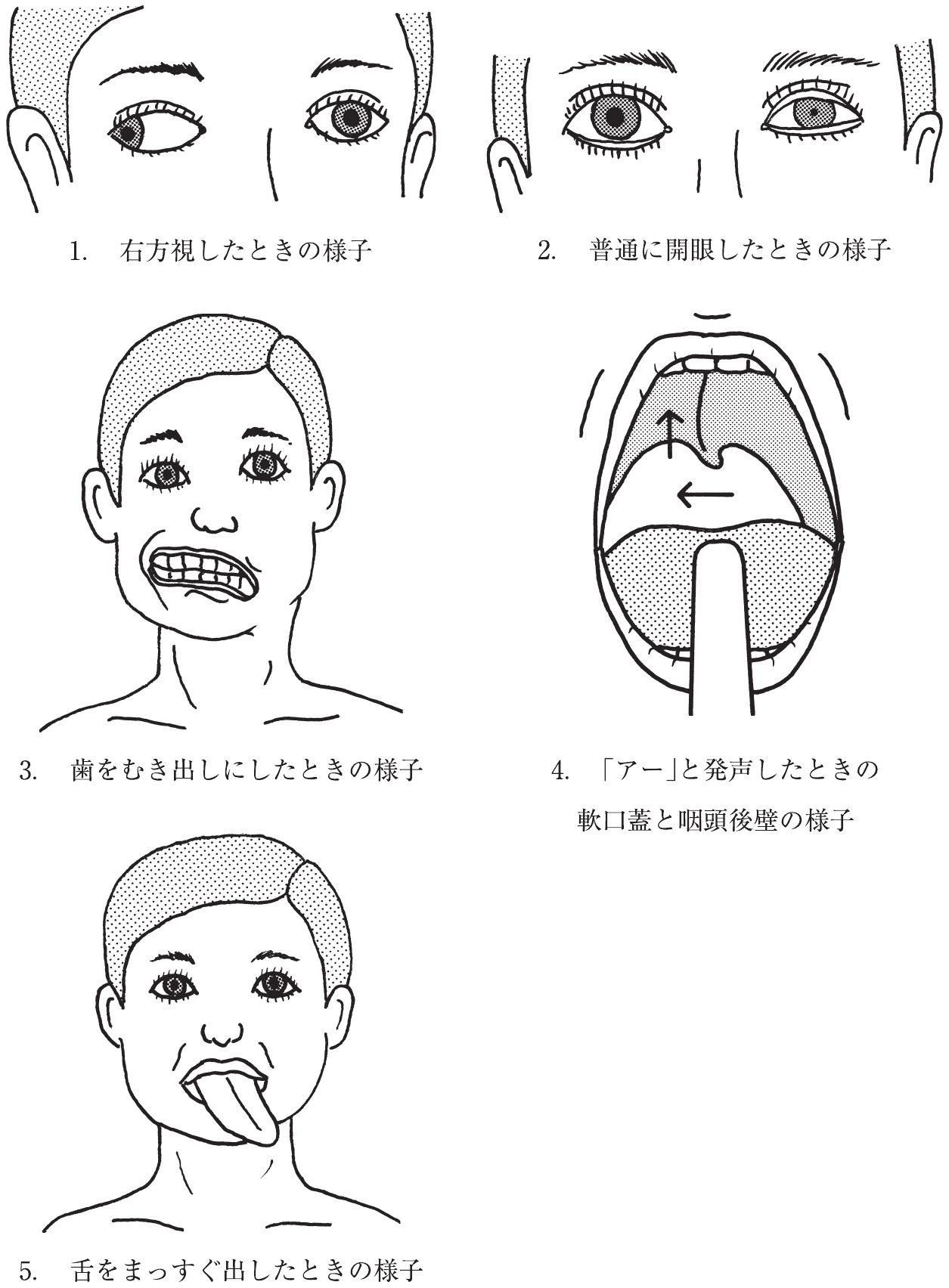 図
