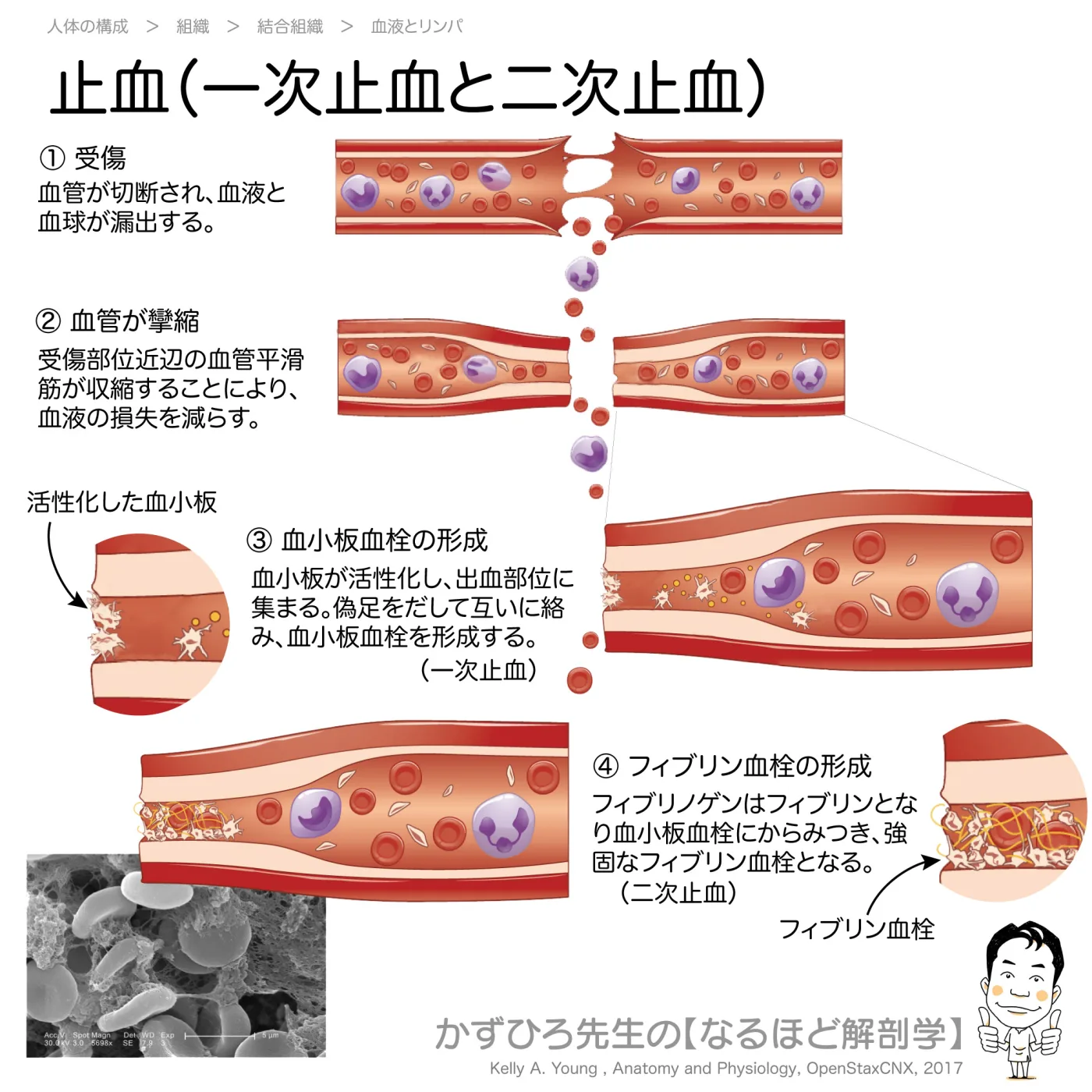 止血機構