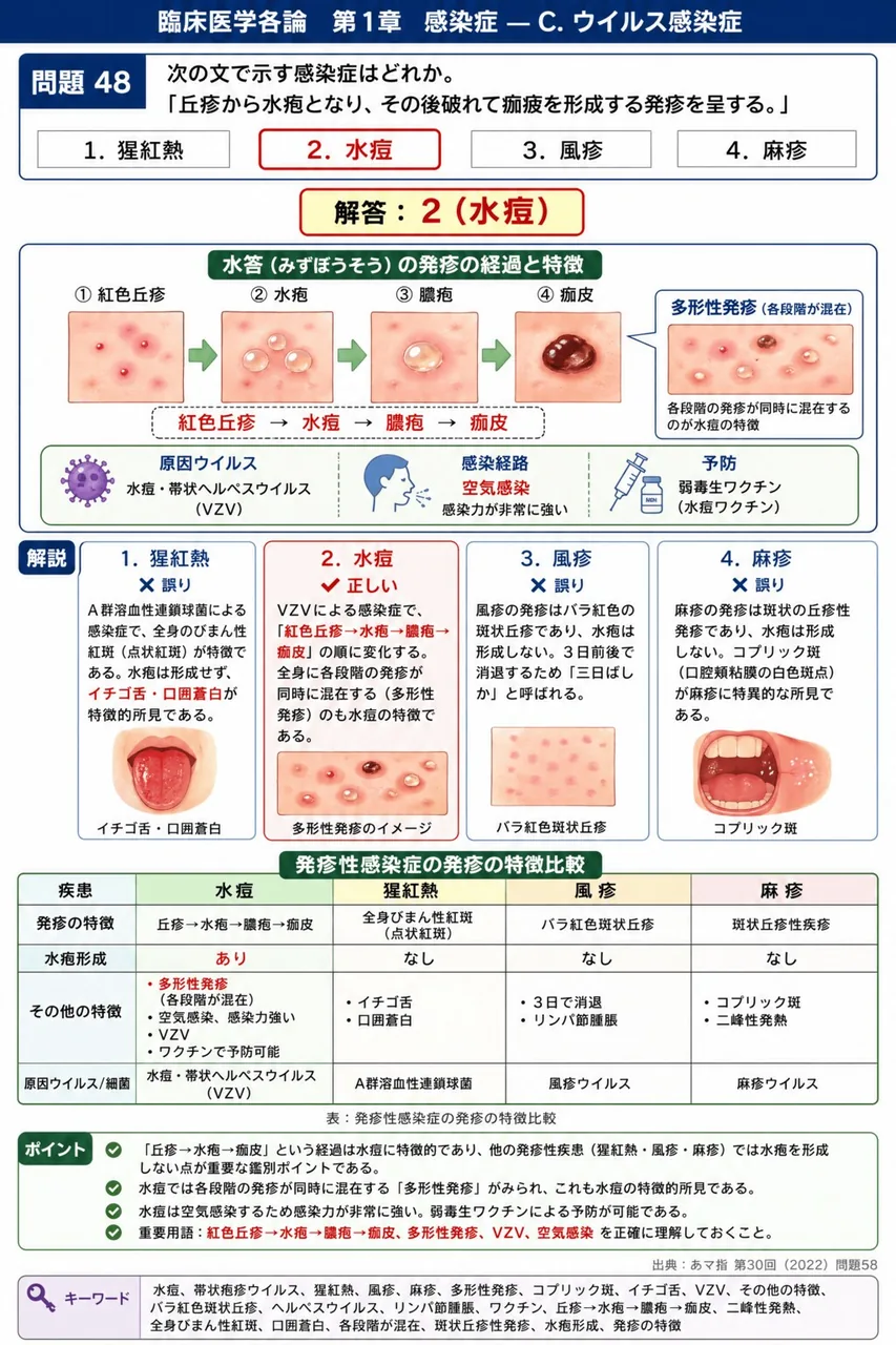 あマ指 第30回(2022) 問題58｜次の文で示す感染症はどれか。「丘疹から水疱となり、その後破れて痂疲を形成する発疹を呈する。」 解説図