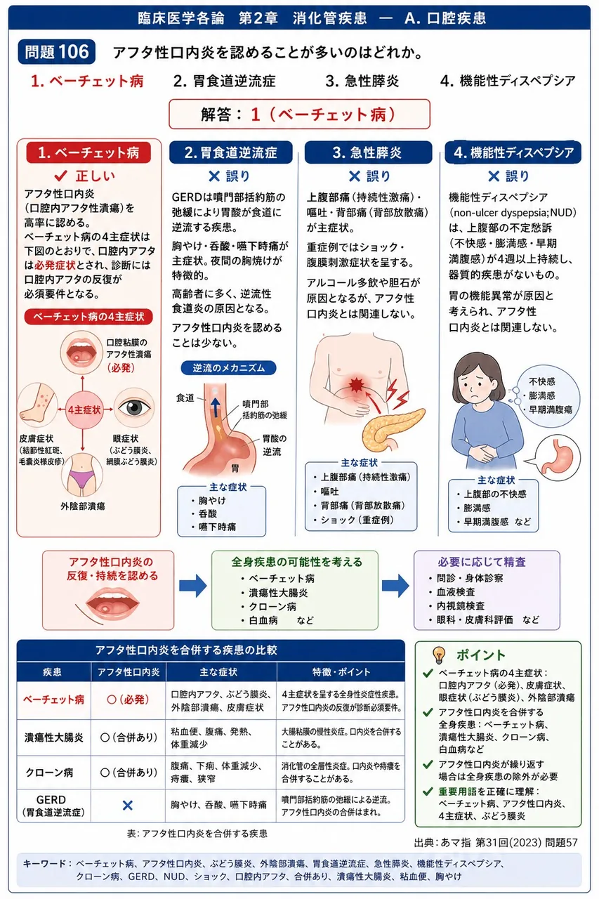 あマ指 第31回(2023) 問題57｜アフタ性口内炎を認めることが多いのはどれか。 解説図
