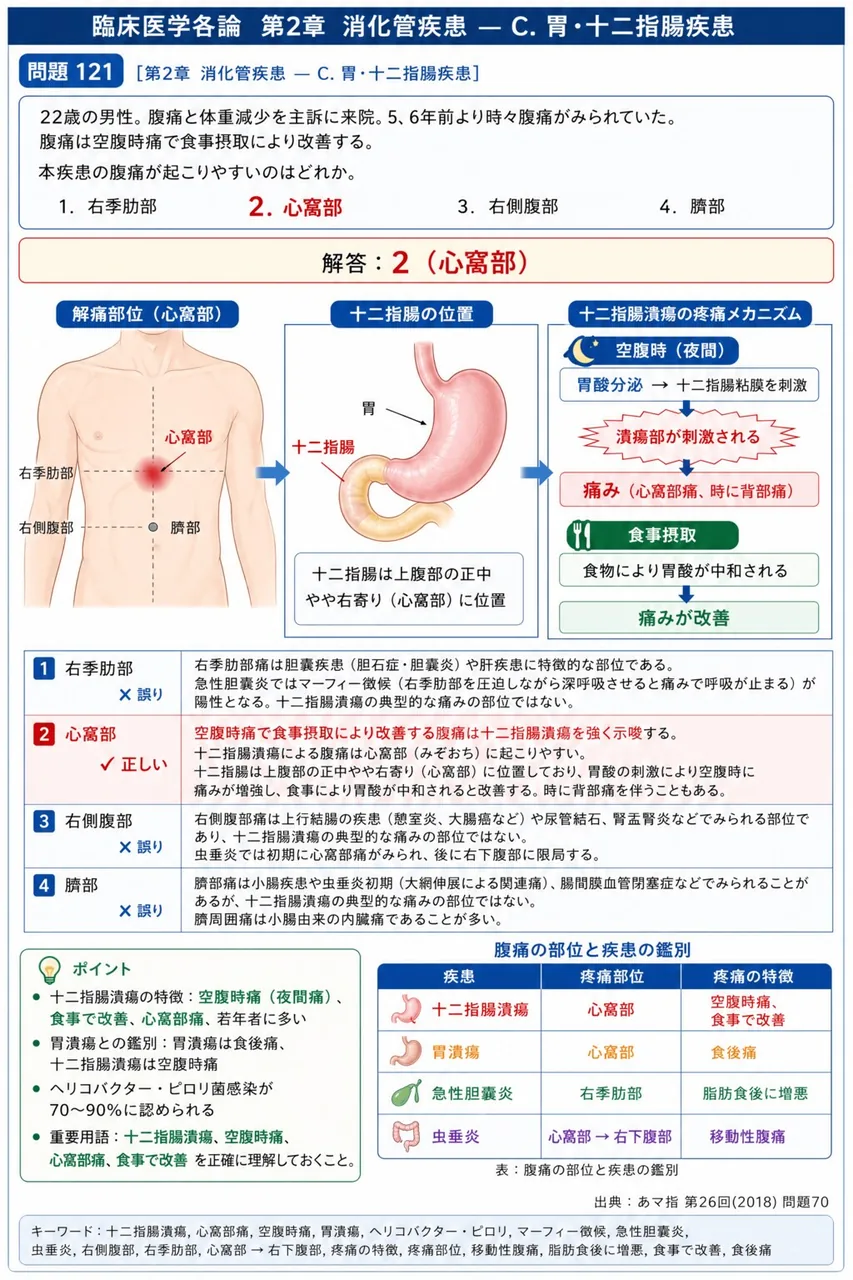 あマ指 第26回(2018) 問題70｜「22歳の男性。腹痛と体重減少を主訴に来院。5、6年前より時々腹痛がみられていた。腹痛は空腹時痛で食事摂取により改善する。」本疾患の腹痛が起こりやすいのはどれか。 解説図