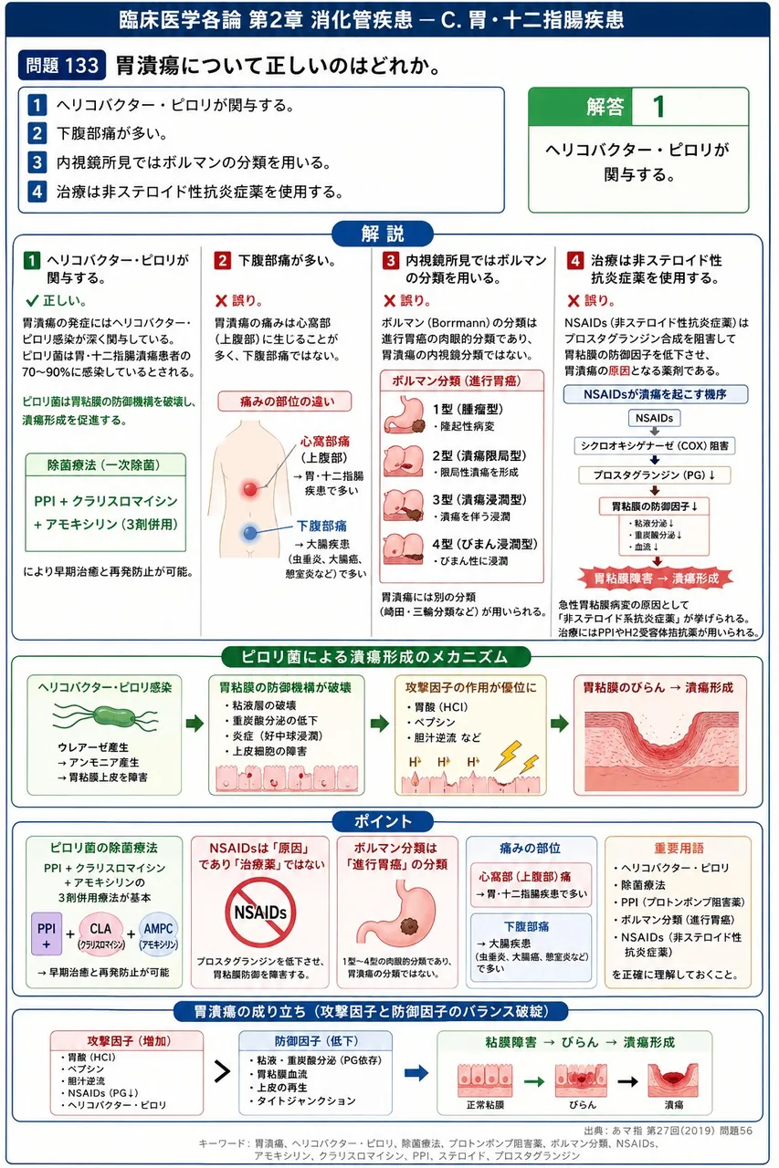 あマ指 第27回(2019) 問題56｜胃潰瘍について正しいのはどれか。 解説図