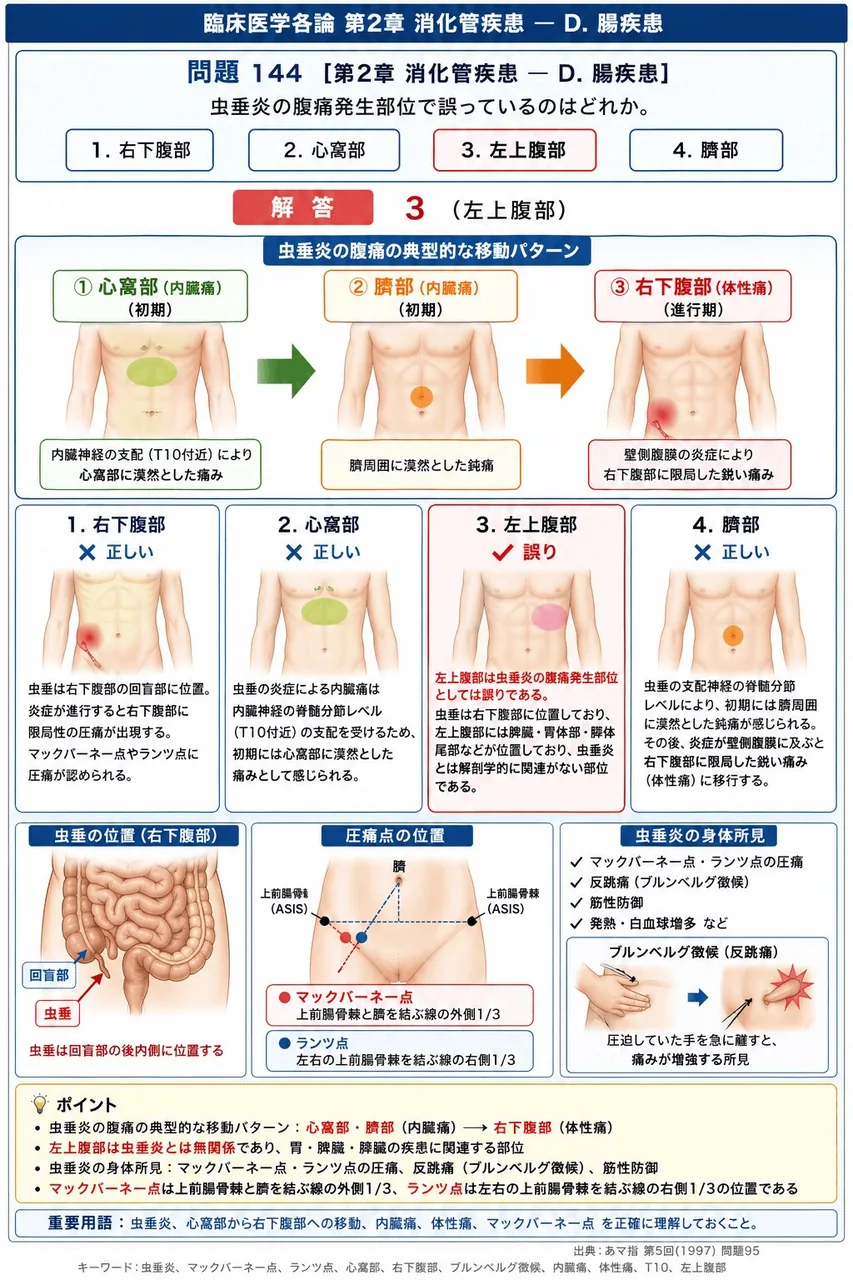 あマ指 第5回(1997) 問題95｜虫垂炎の腹痛発生部位で誤っているのはどれか。 解説図