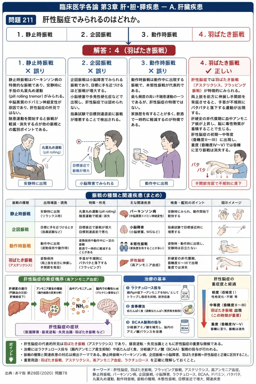 あマ指 第28回(2020) 問題78｜肝性脳症でみられるのはどれか。 解説図