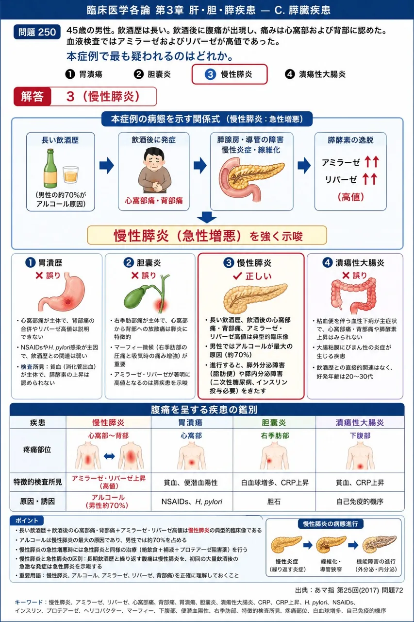 あマ指 第25回(2017) 問題72｜｢45歳の男性。飲酒歴は長い。飲酒後に腹痛が出現し、痛みは心窩部および背部に認めた。血液検査ではアミラーゼおよびリパーゼが高値であった。」本症例で最も疑われるのはどれか。 解説図