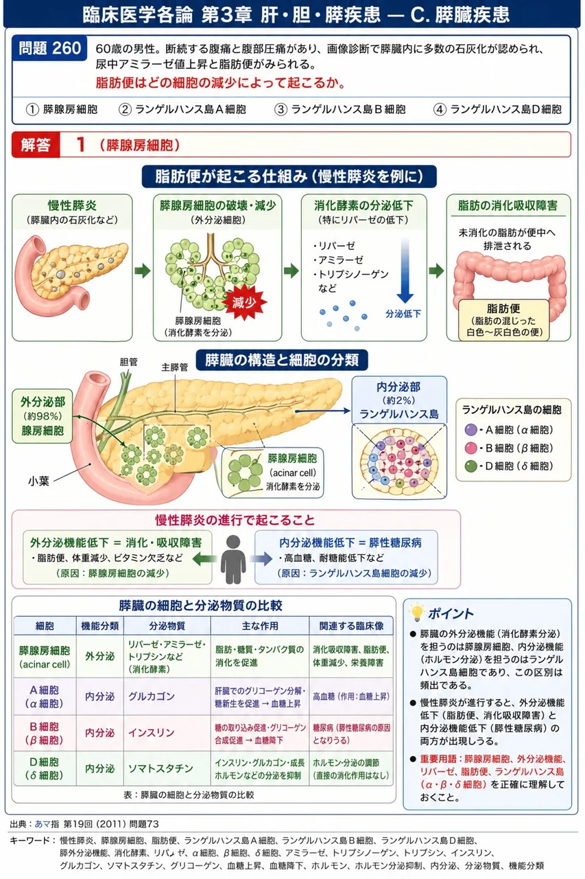 あマ指 第19回(2011) 問題73|「60歳の男性。断続する腹痛と腹部圧痛があり、画像診断で膵臓内に多数の石灰化が認められ、尿中アミラーゼ値上昇と脂肪便がみられる。」脂肪便はどの細胞の減少によって起こるか。 解説図