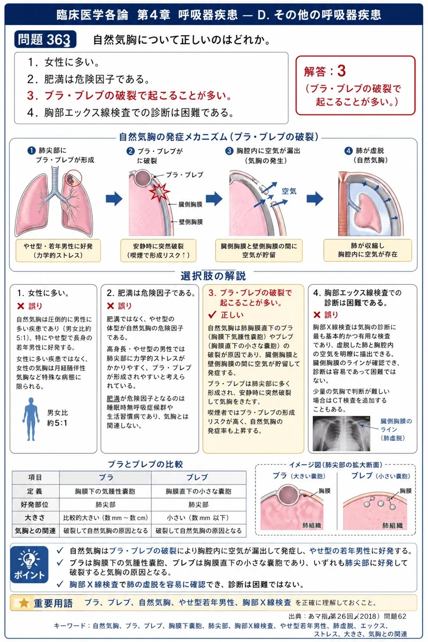 あマ指 第26回(2018) 問題62｜自然気胸について正しいのはどれか。 解説図
