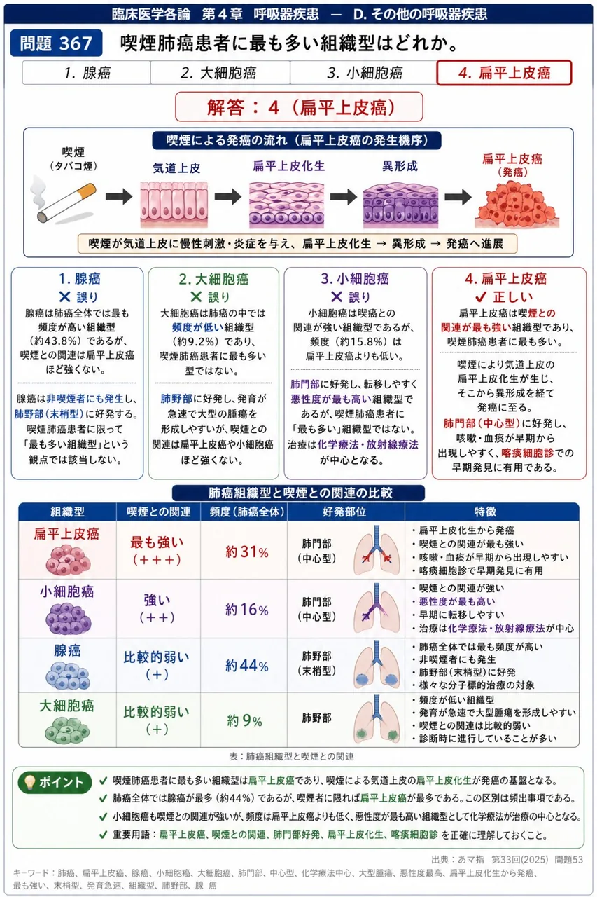 あマ指 第33回(2025) 問題53|喫煙肺癌患者に最も多い組織型はどれか。 解説図