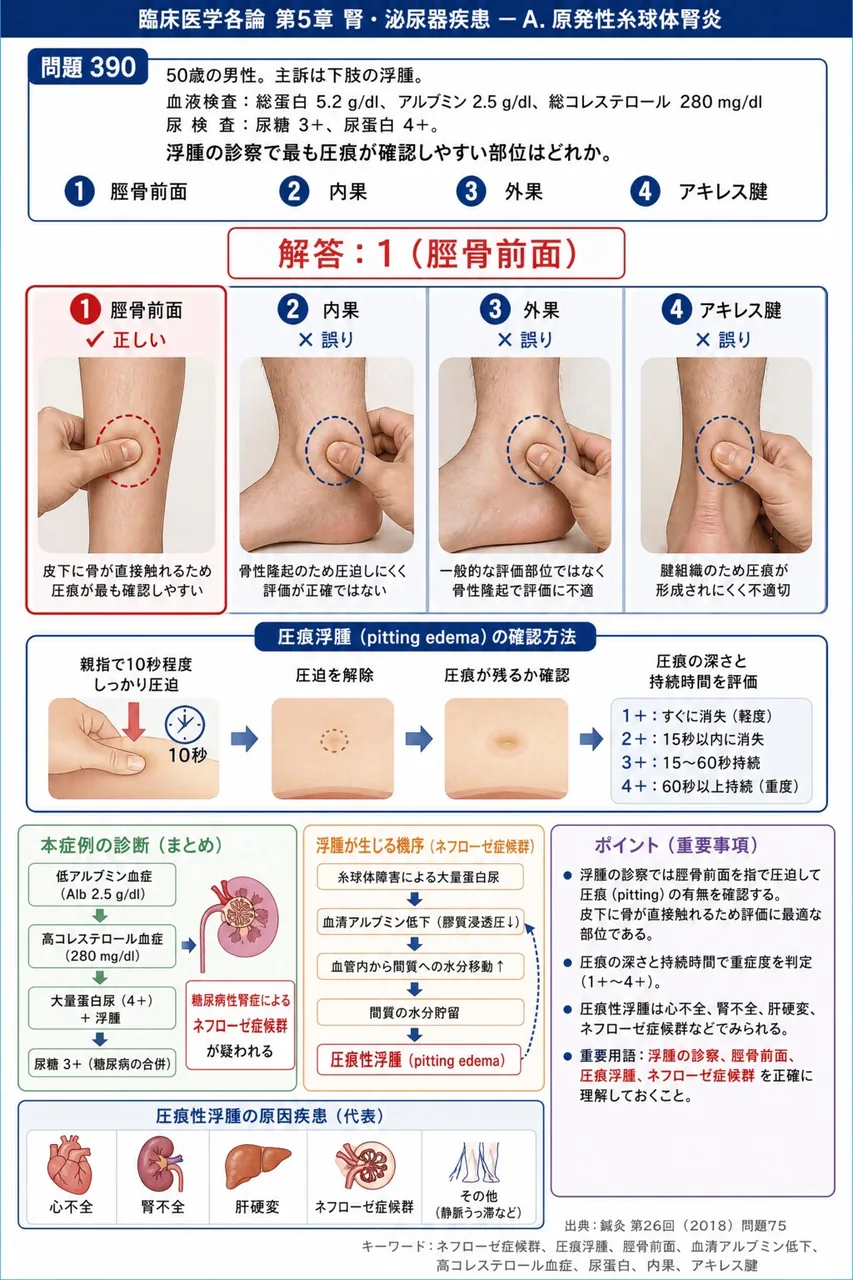 鍼灸 第26回(2018) 問題75｜「50歳の男性。主訴は下肢の浮腫。血液検査は総蛋白5.2g/dl、アルブミン2.5g/dl、総コレステロール280mg/dl。尿検査は尿糖3+、尿蛋白4+。」浮腫の診察で最も圧痕が確認しやすい部位はどれか。 解説図