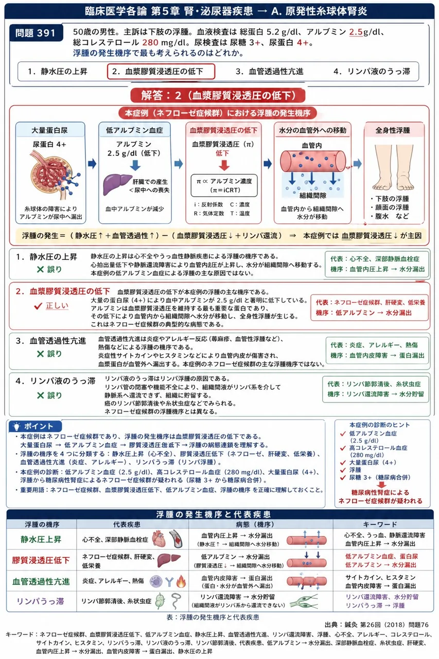 鍼灸 第26回(2018) 問題76｜「50歳の男性。主訴は下肢の浮腫。血液検査は総蛋白5.2g/dl、アルブミン2.5g/dl、総コレステロール280mg/dl。尿検査は尿糖3+、尿蛋白4+。」浮腫の発生機序で最も考えられるのはどれか。 解説図