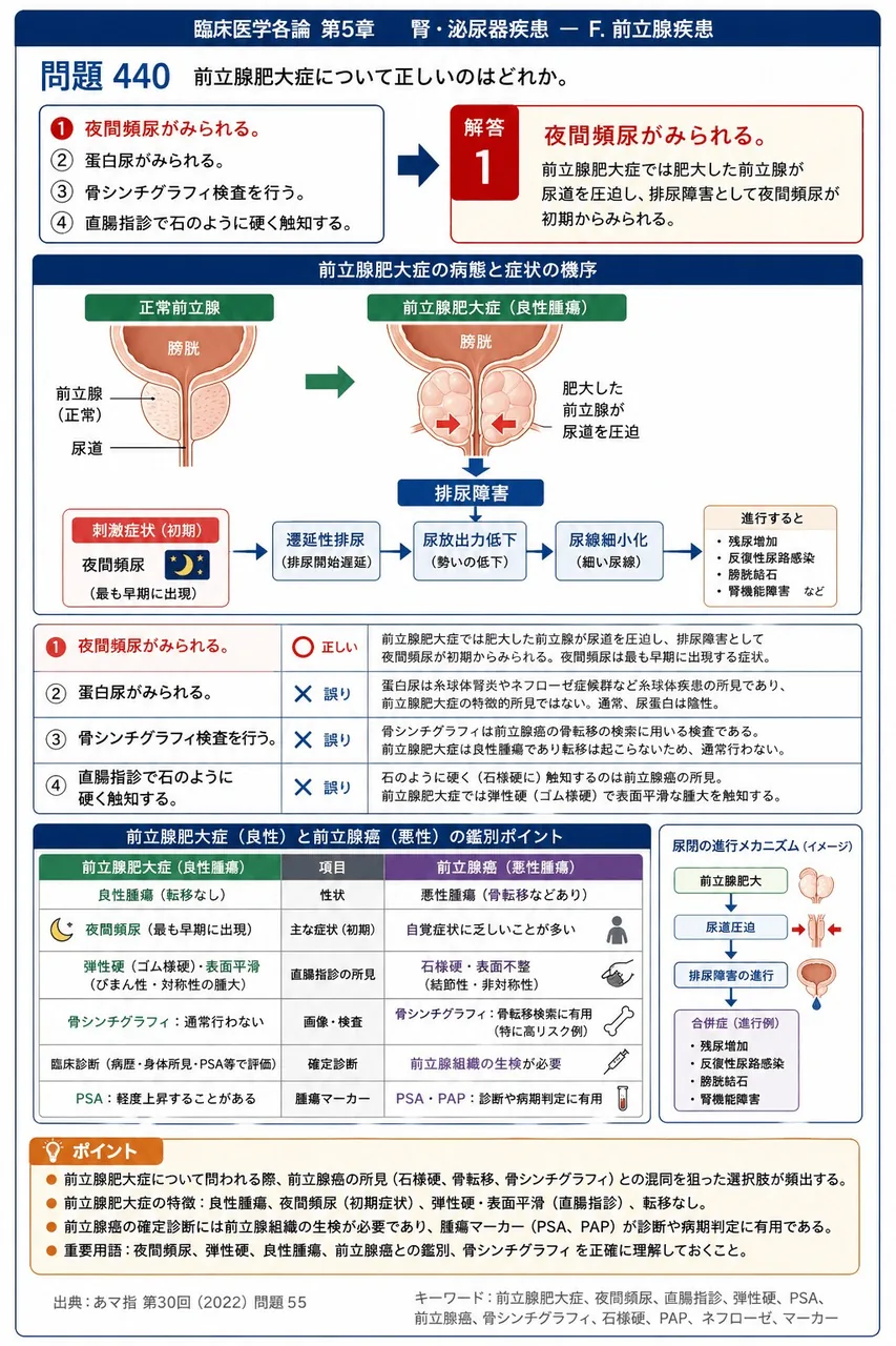 あマ指 第30回(2022) 問題55｜前立腺肥大症について正しいのはどれか。 解説図