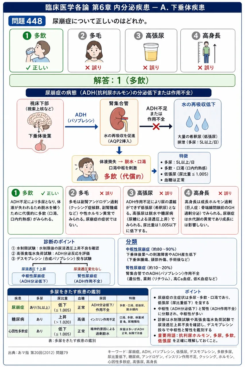 あマ指 第20回(2012) 問題79｜尿崩症について正しいのはどれか。 解説図