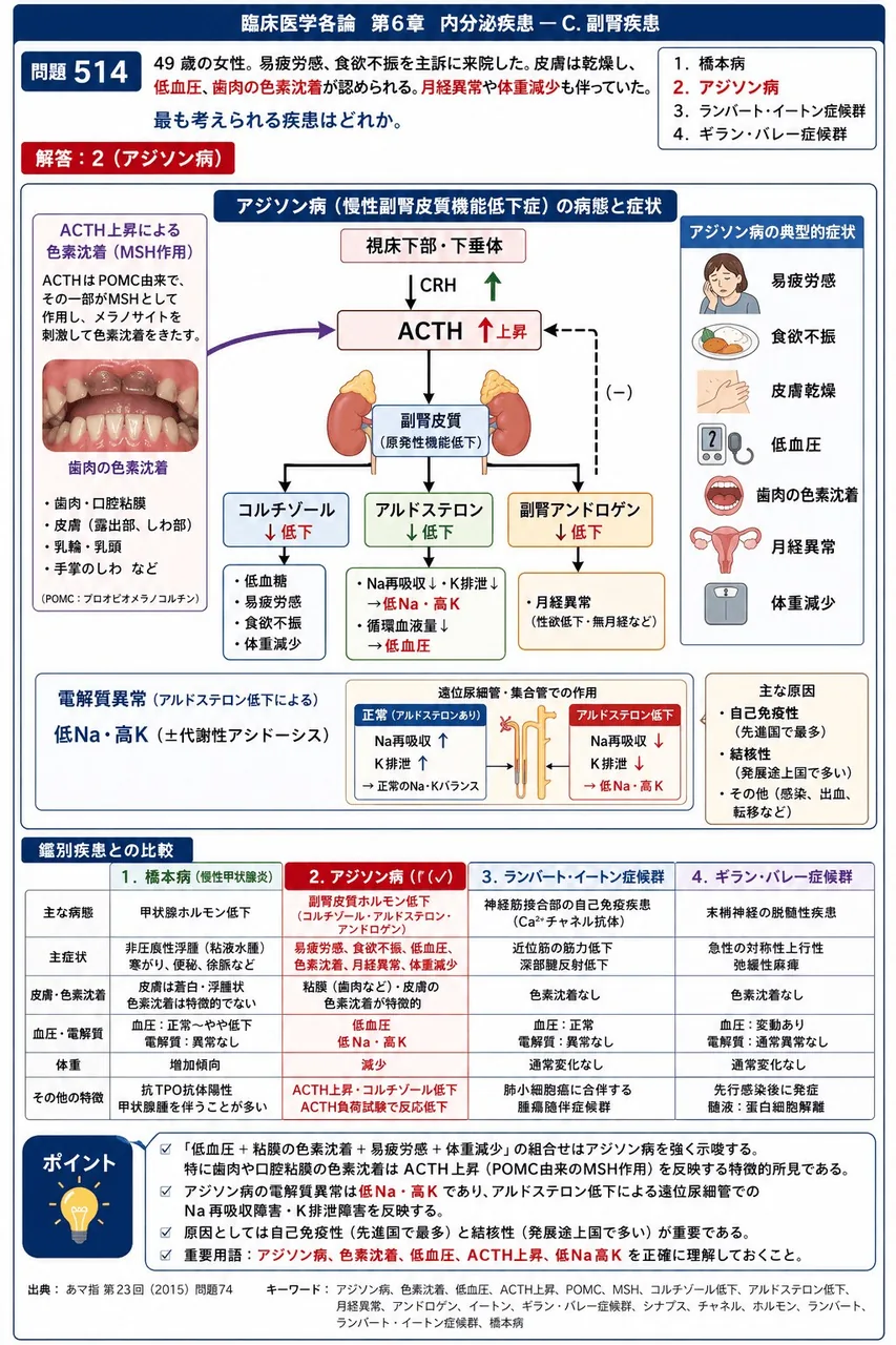 あマ指 第23回(2015) 問題74｜｢49 歳の女性。易疲労感、食欲不振を主訴に来院した。皮膚は乾燥し、低血圧、歯肉の色素沈着が認められる。月経異常や体重減少も伴っていた｡」最も考えられる疾患はどれか。 解説図