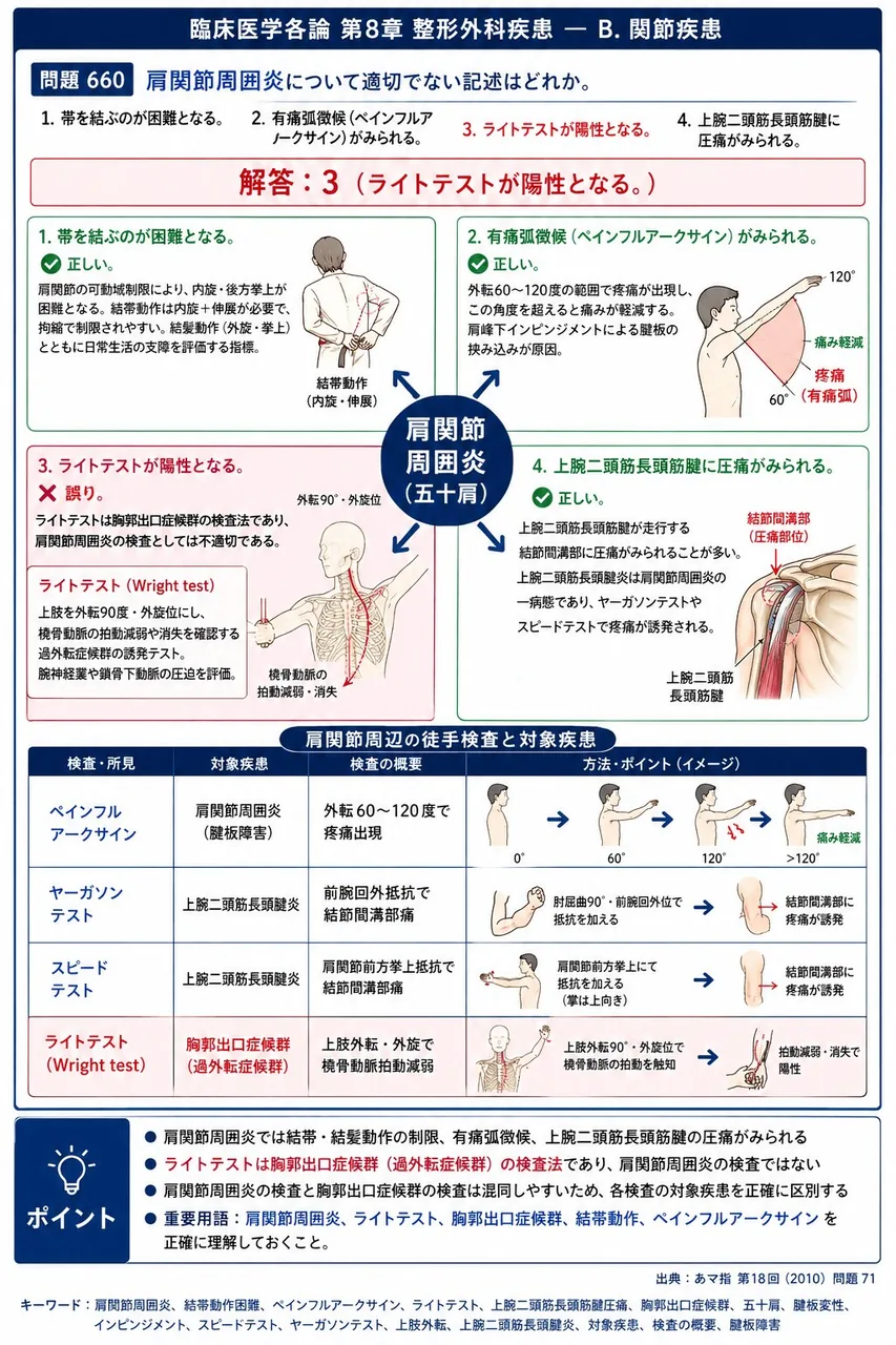 あマ指 第18回(2010) 問題71|肩関節周囲炎について適切でない記述はどれか。 解説図