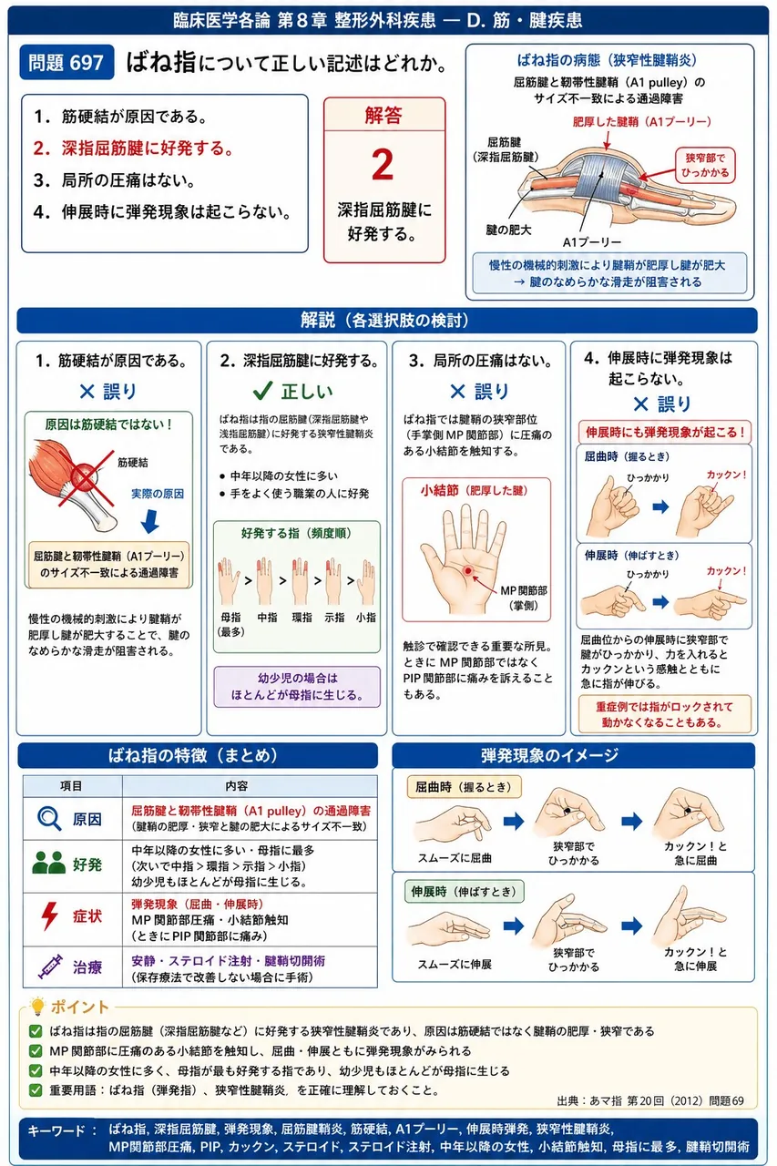あマ指 第20回(2012) 問題69|ばね指について正しい記述はどれか。 解説図