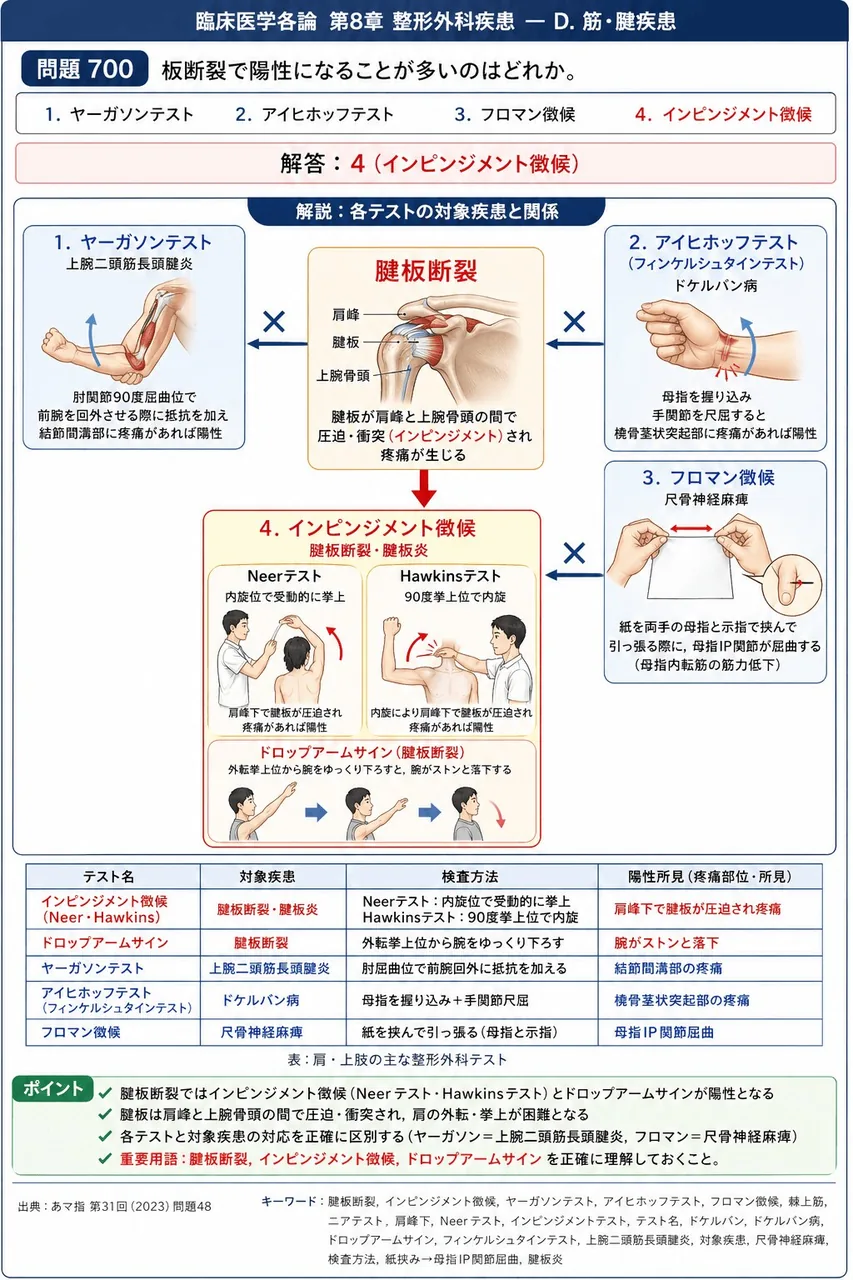 あマ指 第31回(2023) 問題48｜板断裂で陽性になることが多いのはどれか。 解説図