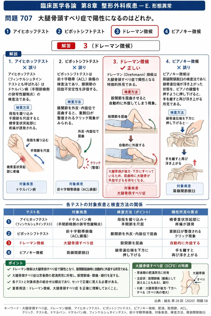 鍼灸 第28回(2020) 問題58｜大腿骨頭すべり症で陽性になるのはどれか。 解説図