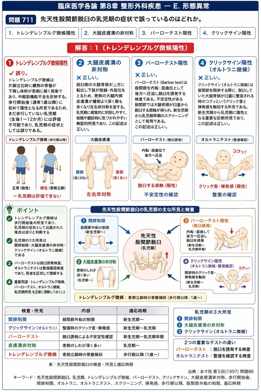 あマ指 第5回(1997) 問題86｜先天性股関節脱臼の乳児期の症状で誤っているのはどれか。 解説図