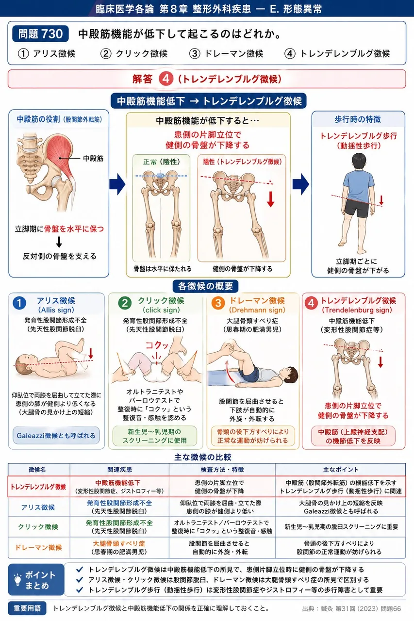 鍼灸 第31回(2023) 問題66|中殿筋機能が低下して起こるのはどれか。 解説図