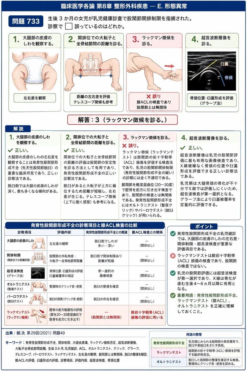 鍼灸 第29回(2021) 問題49|生後 3 か月の女児が乳児健康診査で股関節開排制限を指摘された。診察で□誤っているのはどれか。 解説図
