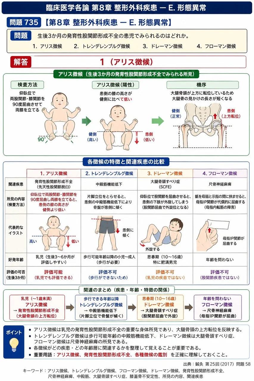 鍼灸 第25回(2017) 問題58|生後3か月の発育性股関節形成不全の患児でみられるのはどれか。 解説図