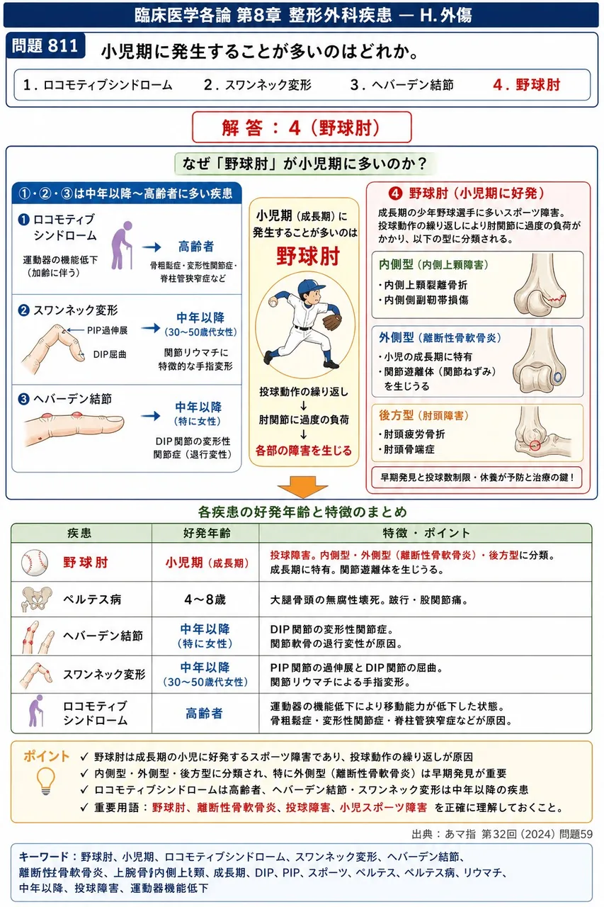 あマ指 第32回(2024) 問題59｜小児期に発生することが多いのはどれか。 解説図