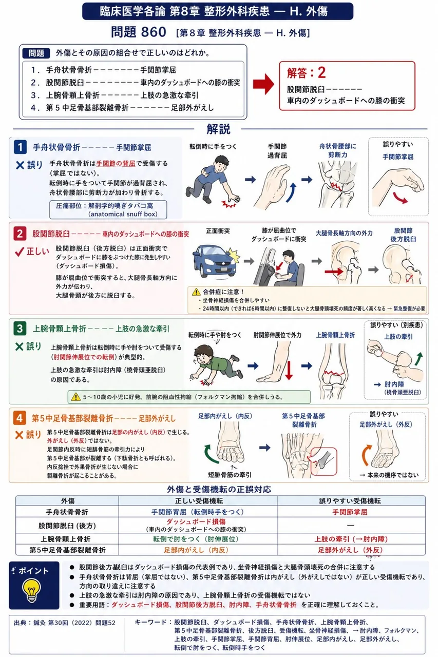 鍼灸 第30回(2022) 問題52|外傷とその原因の組合せで正しいのはどれか。 解説図