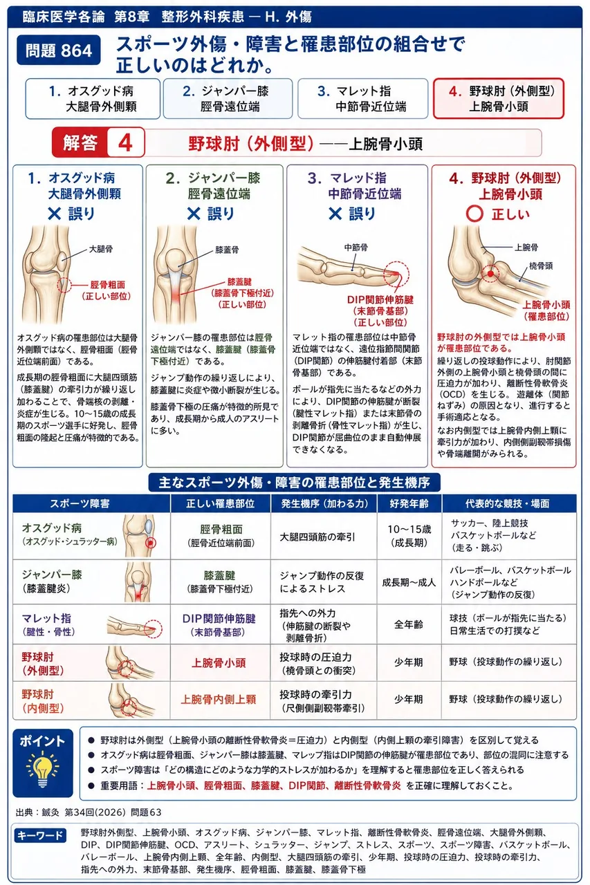 鍼灸 第34回(2026) 問題63｜スポーツ外傷・障害と罹患部位の組合せで正しいのはどれか。 解説図
