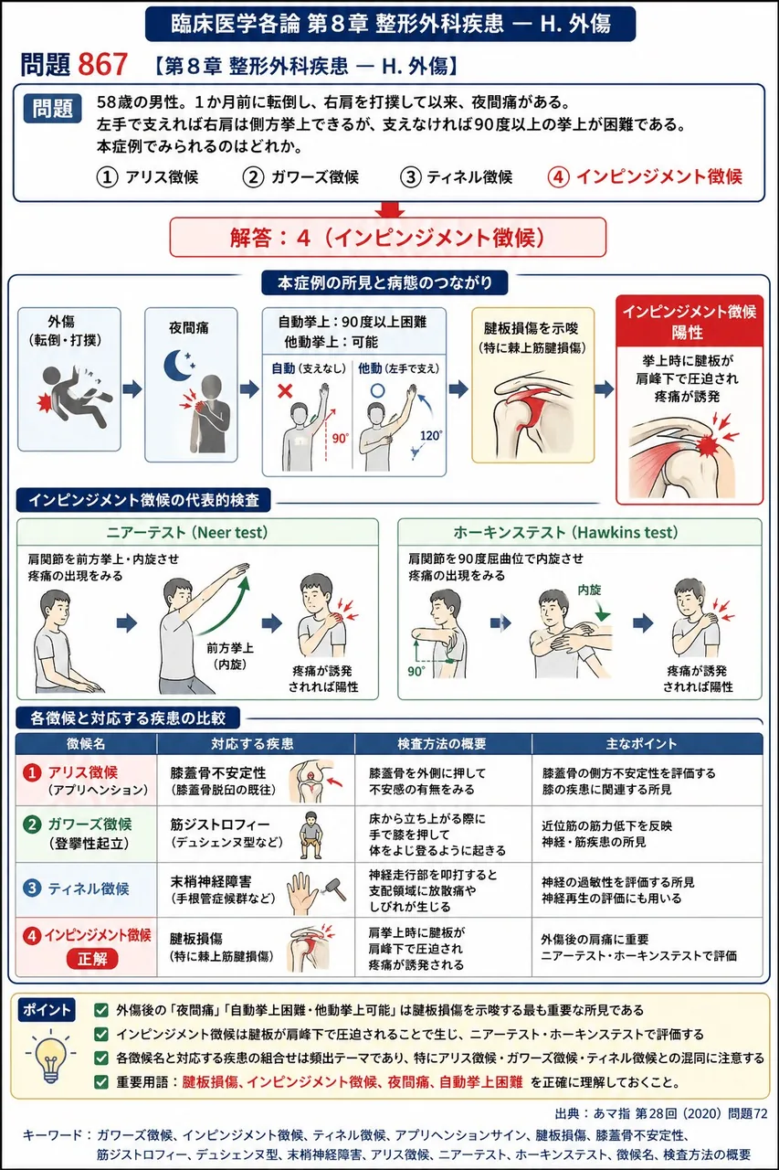 あマ指 第28回(2020) 問題72|「58歳の男性。1か月前に転倒し、右肩を打撲して以来、夜間痛がある。左手で支えれば右肩は側方挙上できるが、支えなければ90度以上の挙上が困難である。」本症例でみられるのはどれか。 解説図