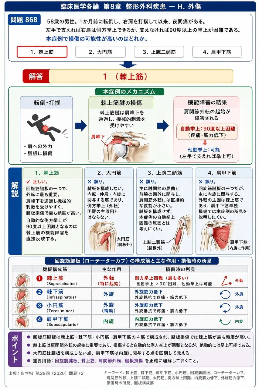 あマ指 第28回(2020) 問題73｜「58歳の男性。1か月前に転倒し、右肩を打撲して以来、夜間痛がある。左手で支えれば右肩は側方挙上できるが、支えなければ90度以上の挙上が困難である。」本症例で損傷の可能性が高いのはどれか。 解説図