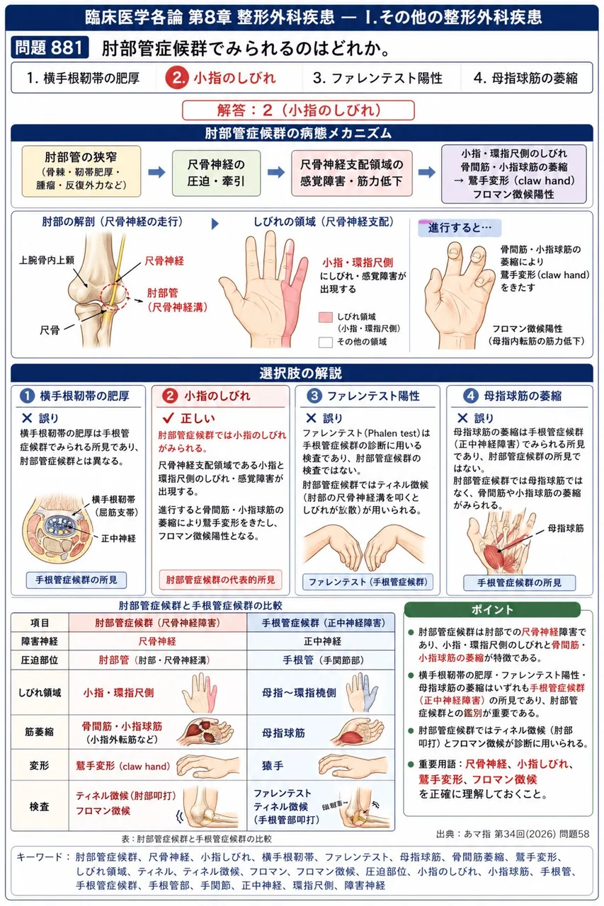 あマ指 第34回(2026) 問題58|肘部管症候群でみられるのはどれか。 解説図