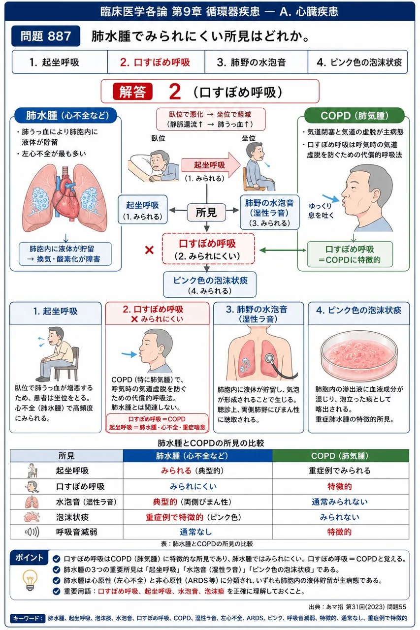 あマ指 第31回(2023) 問題55｜肺水腫でみられにくい所見はどれか。 解説図