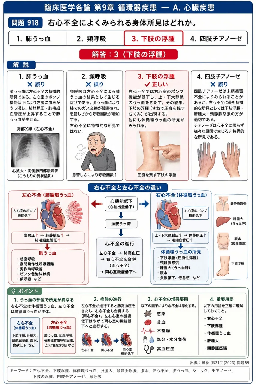 鍼灸 第31回(2023) 問題59｜右心不全によくみられる身体所見はどれか。 解説図